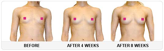 Natural Breast Cream